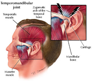 Meyembuhkan TMJ-D (Temporo Mandibular Joint) Disorder: Cepat dan Gratis 